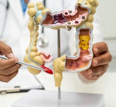 Cirujano Gastrointestinal en Irapuato