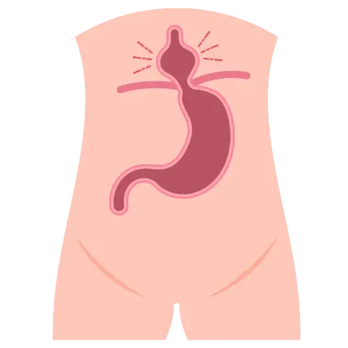 Cirugía de Hernia en Irapuato